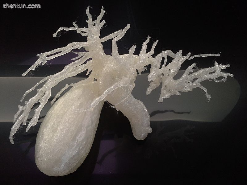 3D Printed biliary system..jpg