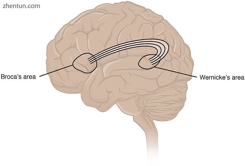 Broca&#039;s area and Wernicke&#039;s area are linked by the arcuate fasciculus..jpg