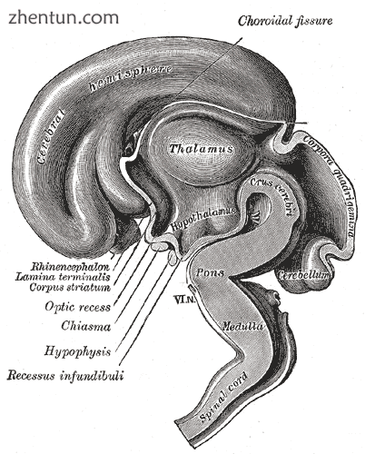 Brain viewed at midline at 3 months.png