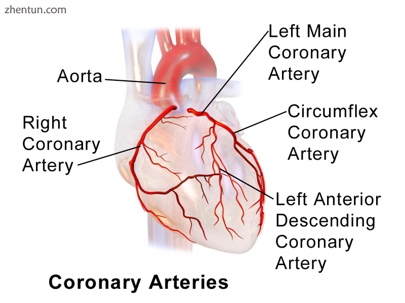 Coronary arteries are affected by this condition.png