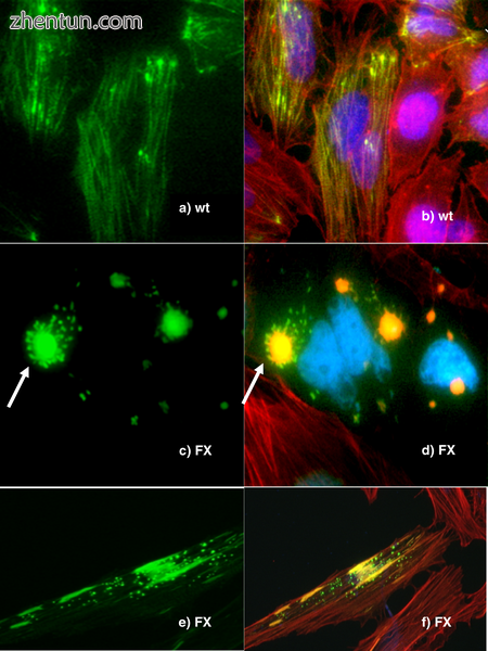 Human cells in which some proteins are fused with green fluorescent protein to a.png