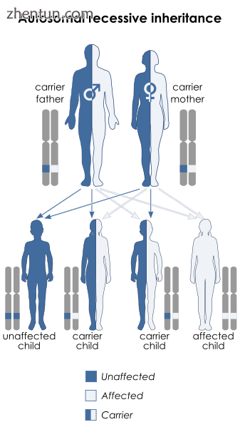 Hyperphenylalaninemia can be inherited in an autosomal recessive manner..png