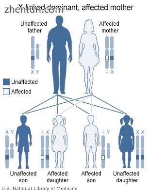 X-linked dominant inheritance works differently depending upon whether the mothe.jpg