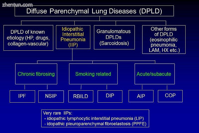 Classification of IIPs.[6].jpg