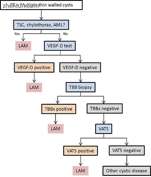 Diagram 1. Outlines a proposed algorithm for the diagnosis of LAM. C.jpg