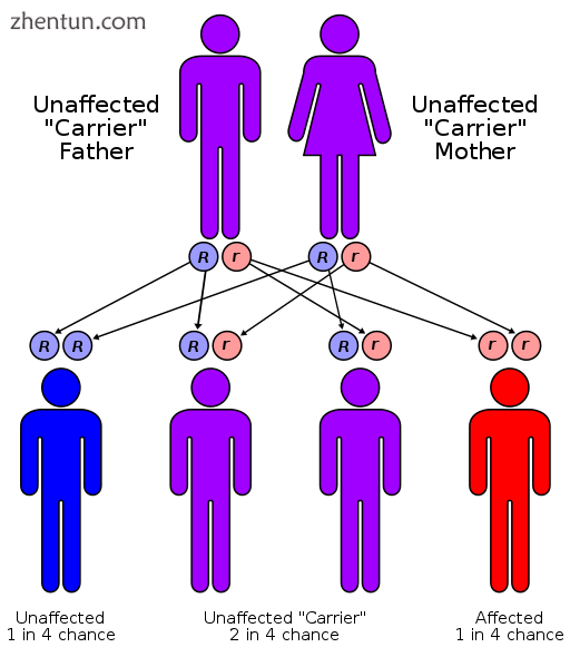 Mucopolysaccharidosis has an autosomal recessive pattern of inheritance..png