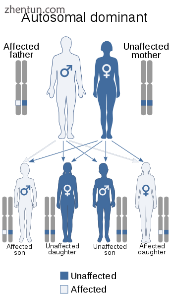 NS is typically inherited in an autosomal dominant pattern with variable expression..png