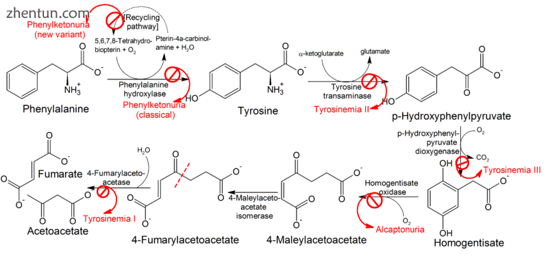 Pathophysiology of phenylketonuria, which is due to the absence of functional pheny.png