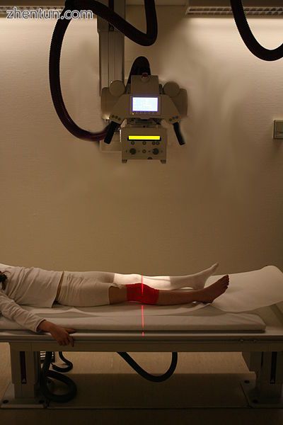 Radiography to identify possible fractures after a knee injury.JPG