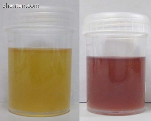 Left figure is urine on the first day while the right figure is urine after 3 da.png