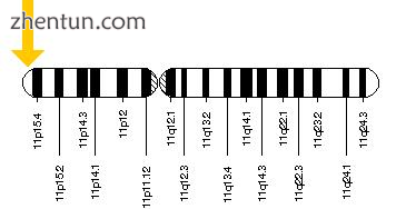 HBB gene (responsible for sickle cell anaemia) is located on the short (p) arm o.png