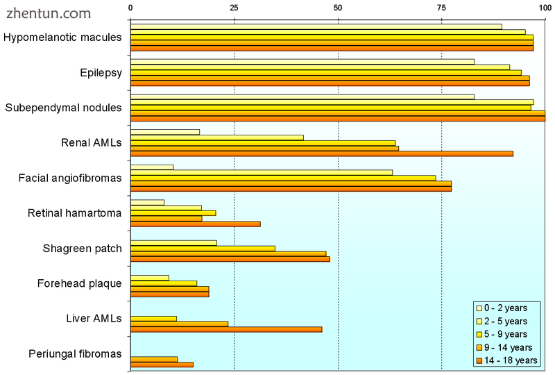 The frequency of signs in children with TSC, grouped by age[9].png