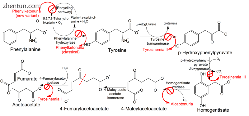 Pathophysiology of metabolic disorders of tyrosine, resulting in elevated levels.png