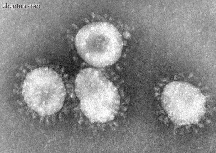 Coronaviruses are a group of viruses known for causing the common cold. They hav.jpg