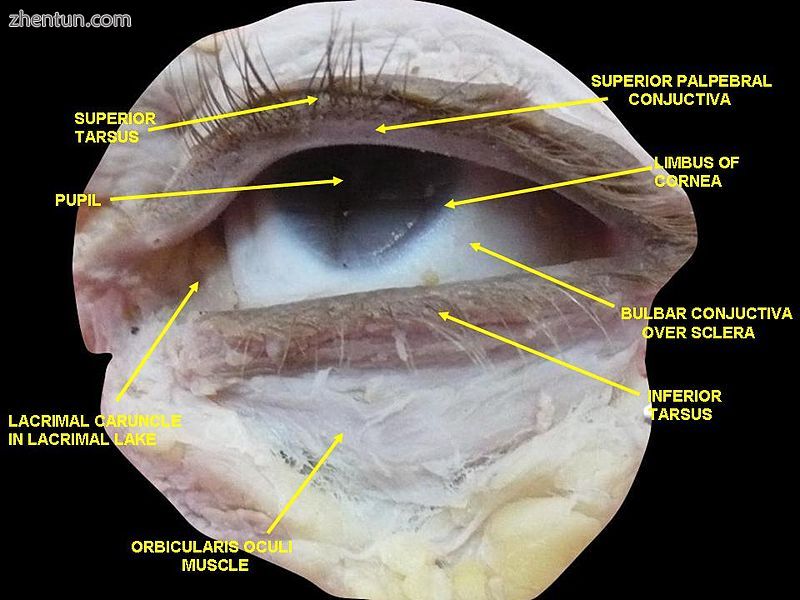 Extrinsic eye muscle. Nerves of orbita. Deep dissection.JPG