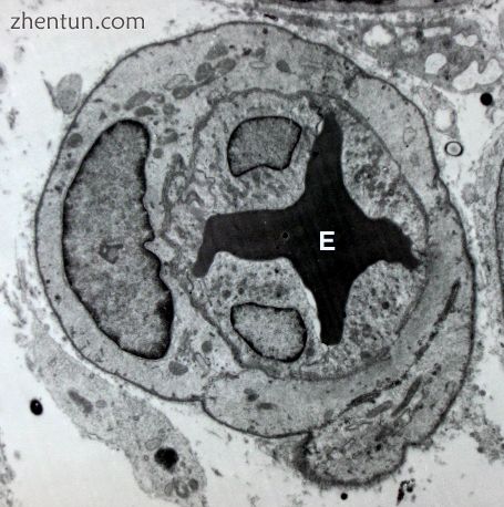 Blood vessel with an erythrocyte (red blood cell, E) within its lumen, endotheli.jpg