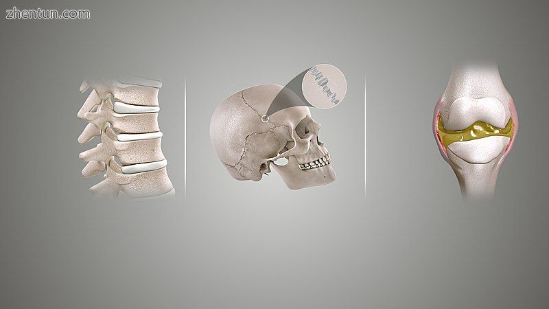 Types of joints based upon their structure (L to R)  Cartilaginous joint, Fibrou.jpg