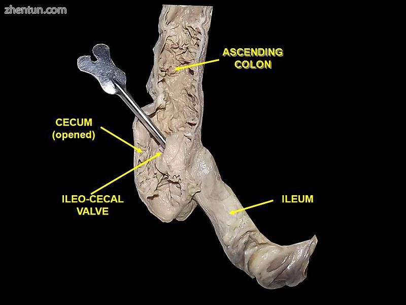 Colon. Deep dissection. Anterior view..JPG