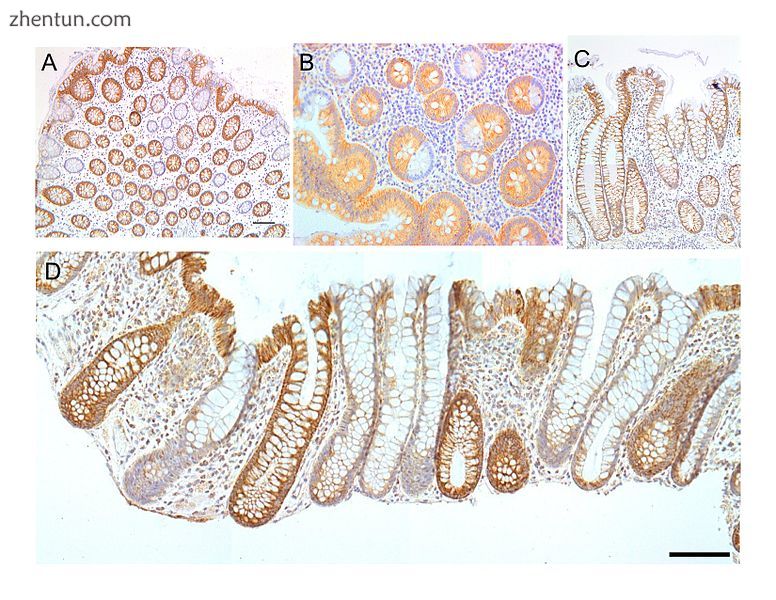 Colonic crypts (intestinal glands) within four tissue sections. The cells have b.jpg