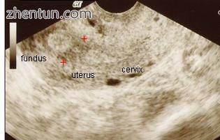 Ultrasound view..jpg