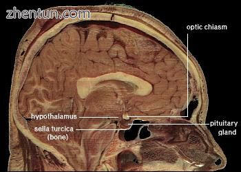Cross-section of a human head, showing location of the hypothalamus..jpg