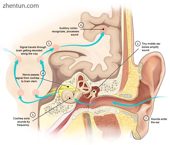 Diagram of signal processing in the auditory system..jpg