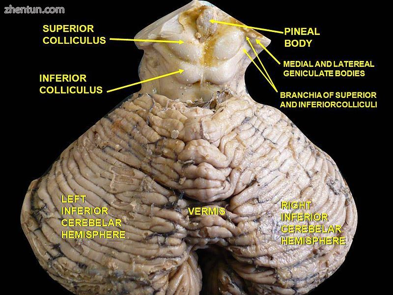 Brainstem. Posterior view..JPG