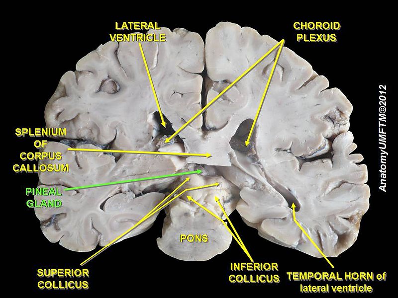 Pineal gland.JPG