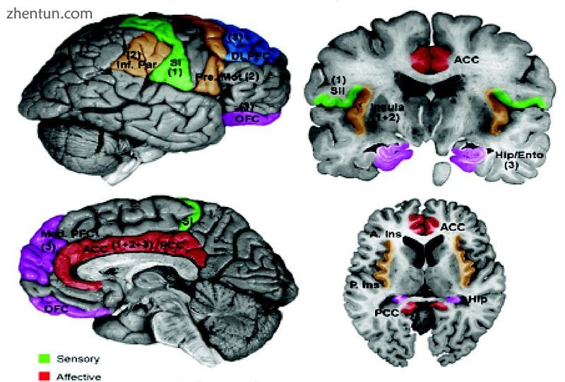Primary somatosensory cortex labeled in green S1.jpg