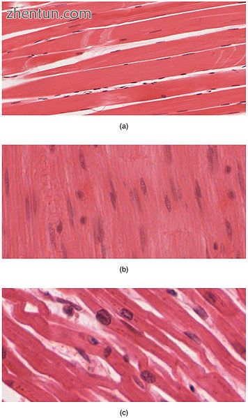 The body contains three types of muscle tissue.jpg