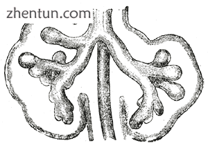 Lungs during development, showing the early branching of the primitive bronchial buds.png
