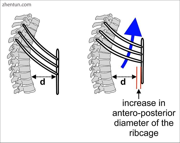 The effect of the respiratory muscles in expanding the rib cage..jpg
