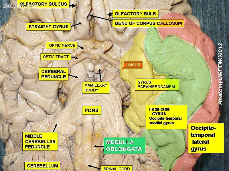 Medulla oblongata.JPG