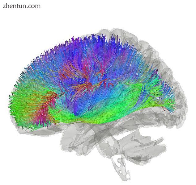Tractography showing corticostriatal connections.jpg