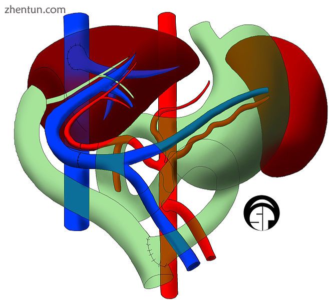 In children, due to their smaller abdominal cavity,.jpg