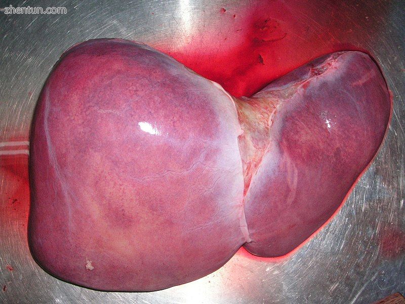 Human liver.jpg