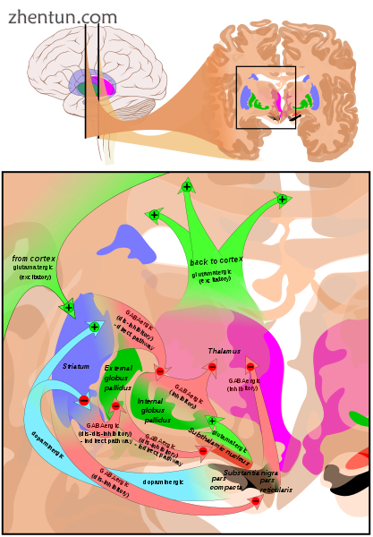 Diagram shows two coronal slices that have been superimposed t.png