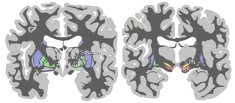 Coronal slices of human brain showing the basal g.png
