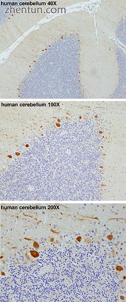 Purkinje cells in the human cerebellum (in orange, from top to bottom 40X, 100X .jpg