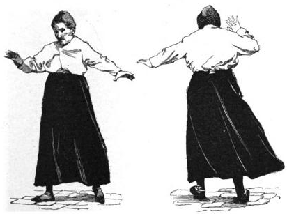 Illustration from 1912 of the altered walking gait of a woman with cerebellar disease.png