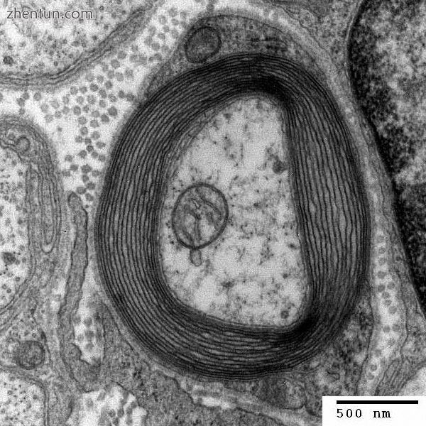 Transmission electron micrograph of a cross-section of a myelinated axon, genera.jpg