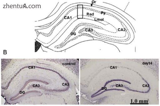 Neuronal loss shown in rat CA1 following ischemia.png