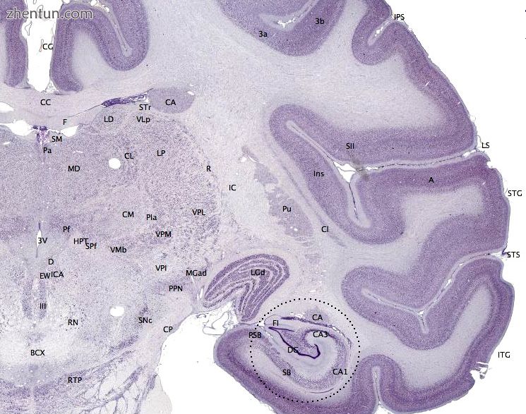 Image 3 Coronal section of the brain of a macaque monkey, showing hippocampus (c.jpg