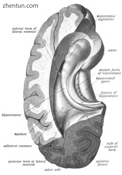 Image 2 Cross-section of cerebral hemisphere showing structure and location of h.png