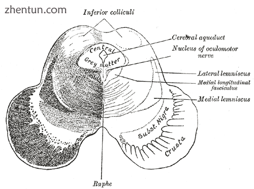 Transverse section of mid-brain at level of inferior colliculi..png