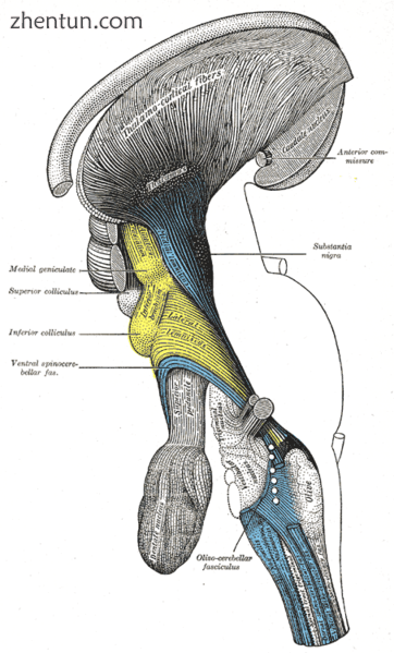 Deep dissection of brain-stem. Lateral view..png