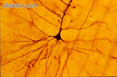 The Golgi stain first allowed for the visualization of individual neurons..jpg