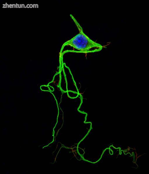Photograph of a stained neuron in a chicken embryo.jpg
