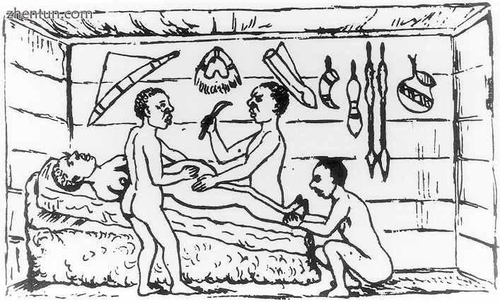 A caesarean section performed by indigenous healers in Kahura, Uganda. As observ.gif