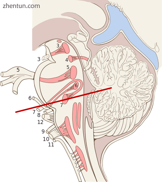A cross-section of the brainstem showing the multiple nuclei of the ten pairs of.png